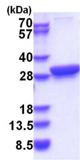 YWHAQ / 14-3-3 Theta Protein