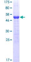 YWHAZ / 14-3-3 Zeta Protein - 12.5% SDS-PAGE of human YWHAZ stained with Coomassie Blue