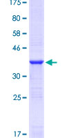 YWHAZ / 14-3-3 Zeta Protein - 12.5% SDS-PAGE Stained with Coomassie Blue.