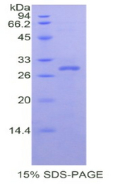 YWHAZ / 14-3-3 Zeta Protein
