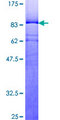 YY1 Protein - 12.5% SDS-PAGE of human YY1 stained with Coomassie Blue