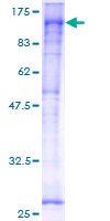 YY1AP1 Protein - 12.5% SDS-PAGE of human YY1AP1 stained with Coomassie Blue