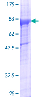 ZAK / MLTK Protein - 12.5% SDS-PAGE of human ZAK stained with Coomassie Blue
