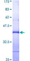 ZAK / MLTK Protein - 12.5% SDS-PAGE Stained with Coomassie Blue.