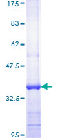 ZAP70 Protein - 12.5% SDS-PAGE Stained with Coomassie Blue.