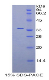 ZAP70 Protein - Recombinant Zeta Chain Associated Protein Kinase 70kDa By SDS-PAGE
