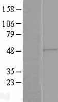 ZAR1 Protein - Western validation with an anti-DDK antibody * L: Control HEK293 lysate R: Over-expression lysate