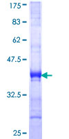 ZBED1 / TRAMP Protein - 12.5% SDS-PAGE Stained with Coomassie Blue.