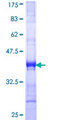 ZBED1 / TRAMP Protein - 12.5% SDS-PAGE Stained with Coomassie Blue.
