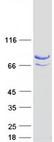 ZBED1 / TRAMP Protein - Purified recombinant protein ZBED1 was analyzed by SDS-PAGE gel and Coomassie Blue Staining