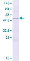 ZBED2 Protein - 12.5% SDS-PAGE of human ZBED2 stained with Coomassie Blue