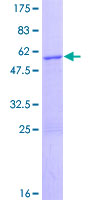 ZBED3 Protein - 12.5% SDS-PAGE of human ZBED3 stained with Coomassie Blue
