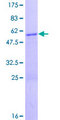 ZBED3 Protein - 12.5% SDS-PAGE of human ZBED3 stained with Coomassie Blue