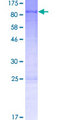 ZBED5 Protein - 12.5% SDS-PAGE of human ZBED5 stained with Coomassie Blue
