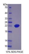 ZBED9 / SCAND3 Protein - Recombinant  SCAN Domain Containing Protein 3 By SDS-PAGE