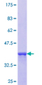 ZBP1 Protein - 12.5% SDS-PAGE Stained with Coomassie Blue.