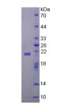 ZBP1 Protein - Recombinant Z-DNA Binding Protein 1 By SDS-PAGE