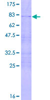 ZBTB12 / G10 Protein - 12.5% SDS-PAGE of human ZBTB12 stained with Coomassie Blue