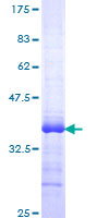 ZBTB16 / PLZF Protein - 12.5% SDS-PAGE Stained with Coomassie Blue.