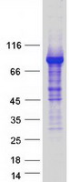 ZBTB16 / PLZF Protein - Purified recombinant protein ZBTB16 was analyzed by SDS-PAGE gel and Coomassie Blue Staining