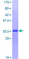 ZBTB20 Protein - 12.5% SDS-PAGE Stained with Coomassie Blue.