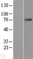 ZBTB22 Protein - Western validation with an anti-DDK antibody * L: Control HEK293 lysate R: Over-expression lysate