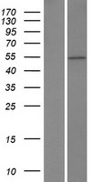 ZBTB25 Protein - Western validation with an anti-DDK antibody * L: Control HEK293 lysate R: Over-expression lysate