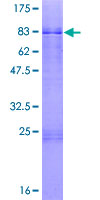 ZBTB26 Protein - 12.5% SDS-PAGE of human ZBTB26 stained with Coomassie Blue