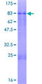 ZBTB26 Protein - 12.5% SDS-PAGE of human ZBTB26 stained with Coomassie Blue