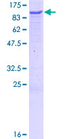 ZBTB3 Protein - 12.5% SDS-PAGE of human ZBTB3 stained with Coomassie Blue