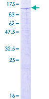 ZBTB33 / Kaiso Protein - 12.5% SDS-PAGE of human ZBTB33 stained with Coomassie Blue