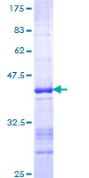 ZBTB33 / Kaiso Protein - 12.5% SDS-PAGE Stained with Coomassie Blue.