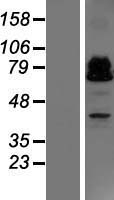 ZBTB46 Protein - Western validation with an anti-DDK antibody * L: Control HEK293 lysate R: Over-expression lysate