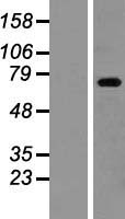 ZBTB48 / HKR3 Protein - Western validation with an anti-DDK antibody * L: Control HEK293 lysate R: Over-expression lysate
