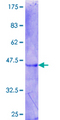 ZBTB6 Protein - 12.5% SDS-PAGE Stained with Coomassie Blue.
