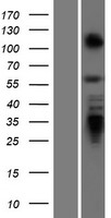 ZBTB7A / Pokemon Protein - Western validation with an anti-DDK antibody * L: Control HEK293 lysate R: Over-expression lysate