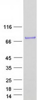 ZBTB7A / Pokemon Protein - Purified recombinant protein ZBTB7A was analyzed by SDS-PAGE gel and Coomassie Blue Staining