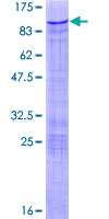 ZBTB7B / HcKrox Protein - 12.5% SDS-PAGE of human ZBTB7B stained with Coomassie Blue