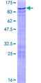 ZBTB7B / HcKrox Protein - 12.5% SDS-PAGE of human ZBTB7B stained with Coomassie Blue