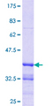 ZBTB7B / HcKrox Protein - 12.5% SDS-PAGE Stained with Coomassie Blue.