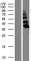 ZBTB8B Protein - Western validation with an anti-DDK antibody * L: Control HEK293 lysate R: Over-expression lysate