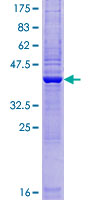 ZBTB8OS Protein - 12.5% SDS-PAGE of human ZBTB8OS stained with Coomassie Blue