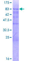 ZBTB9 Protein - 12.5% SDS-PAGE of human ZBTB9 stained with Coomassie Blue