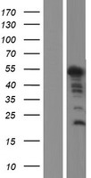 ZC2HC1C Protein - Western validation with an anti-DDK antibody * L: Control HEK293 lysate R: Over-expression lysate