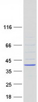 ZC2HC1C Protein - Purified recombinant protein ZC2HC1C was analyzed by SDS-PAGE gel and Coomassie Blue Staining
