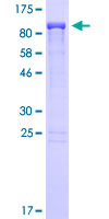 ZC3H12A / MCPIP1 Protein - 12.5% SDS-PAGE of human ZC3H12A stained with Coomassie Blue