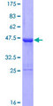 ZC3H7A Protein - 12.5% SDS-PAGE of human ZC3H7A stained with Coomassie Blue