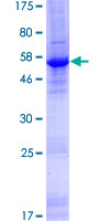ZC3HAV1L Protein - 12.5% SDS-PAGE of human ZC3HAV1L stained with Coomassie Blue