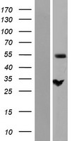 ZC3HC1 / NIPA Protein - Western validation with an anti-DDK antibody * L: Control HEK293 lysate R: Over-expression lysate