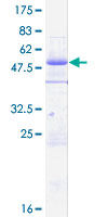 ZC3HC1 / NIPA Protein - 12.5% SDS-PAGE of human ZC3HC1 stained with Coomassie Blue